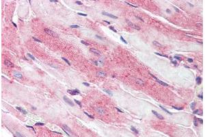 Mouse heart: Formalin-Fixed, Paraffin-Embedded (FFPE) (CD36 antibody  (AA 99-114))