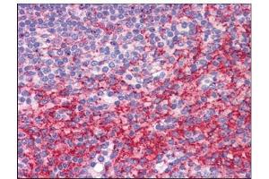 Human Spleen: Formalin-Fixed, Paraffin-Embedded (FFPE) (ATG9B antibody  (C-Term))