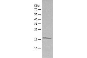 Western Blotting (WB) image for ADAM Metallopeptidase Domain 21 (ADAM21) (AA 200-400) protein (His tag) (ABIN7289339) (ADAM21 Protein (AA 200-400) (His tag))