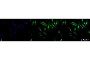 Immunocytochemistry/Immunofluorescence analysis using Rabbit Anti-Alpha B Crystallin Polyclonal Antibody .