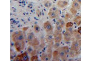 Used in DAB staining on fromalin fixed paraffin-embedded liver tissue (Aggrecan antibody  (AA 34-147))