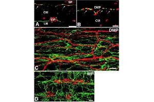 Double-labeling immunofluorescence for c-Kit and nitric oxide synthase (NOS) in the guinea-pig small intestine. (Guinea Pig Serum Sterile)