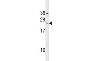 RAB5B antibody western blot analysis in HepG2 lysate. (RAB5B antibody  (AA 85-112))