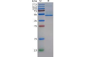CD5 Molecule-Like (CD5L) (AA 20-347) protein (His tag)