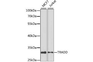 Western blot analysis of extracts of various cell lines, using TRADD antibody. (TRADD antibody)