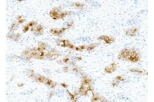 anti-Carcinoembryonic Antigen-Related Cell Adhesion Molecule 5 (CEACAM5) (AA 35-685) antibody