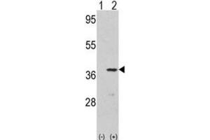Western Blotting (WB) image for anti-Cyclin-Dependent Kinase 3 (CDK3) antibody (ABIN3003266) (CDK3 antibody)