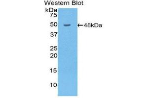 Western Blotting (WB) image for anti-Hyaluronidase-1 (HYAL1) (AA 52-462) antibody (ABIN3201924) (HYAL1 antibody  (AA 52-462))