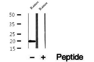 Western blot analysis of extracts of Ramos cells, using FAM96B antibody. (FAM96B antibody  (Internal Region))