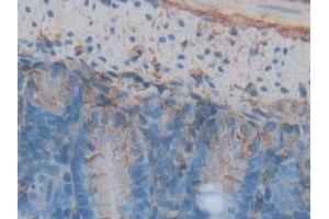 DAB staining on IHC-P; Samples: Mouse Intestine Tissue (Annexin V antibody  (AA 1-319))