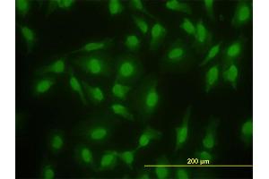 Immunofluorescence of monoclonal antibody to SMAD2 on HeLa cell. (SMAD2 antibody  (AA 181-280))