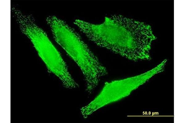 SLC25A20 antibody  (AA 1-301)