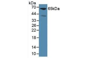 Western blot analysis of Mouse Liver Tissue. (Glypican 3 antibody  (AA 344-559))