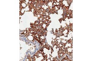 Immunohistochemical analysis of paraffin-embedded mouse lung tissue using (ABIN1539189 and ABIN2838276) performed on the Leica® BOND RXm. (TREM2 antibody  (N-Term))