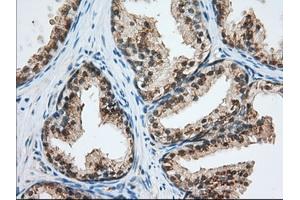 Immunohistochemical staining of paraffin-embedded Human Kidney tissue using anti-USP5 mouse monoclonal antibody.