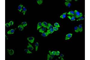 Immunofluorescence staining of Hela cells with ABIN7143330 at 1:33, counter-stained with DAPI. (ADCY5 antibody  (AA 584-719))