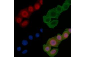 ABIN6255304 and ABIN6267326 staining Hela cells(24h of starvation treatment) by IF/ICC.