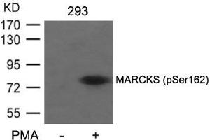 Western blot analysis of extracts from 293 cells untreated or treated with PMA using MARCKS(Phospho-Ser162) Antibody. (MARCKS antibody  (pSer162))