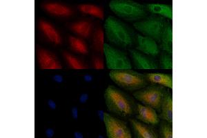 ABIN6261292 and ABIN6278563 staining  cells by IF/ICC.