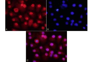 HepG2 cells probed with Rabbit Anti-HURP Polyclonal Antibody (ABIN713861) at 1:200 for overnight 4C followed by Goat Anti-Rabbit IgG, Cy3 conjugated for 40 minutes, at room temperature. (DLGAP5 antibody  (AA 51-150))