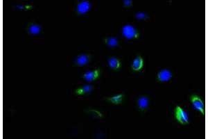 Immunofluorescence staining of A549 cells with ABIN7143175 at 1:166, counter-stained with DAPI. (Activin A Receptor Type IB/ALK-4 antibody  (AA 150-300))