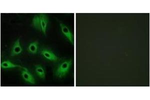 Immunofluorescence analysis of HeLa cells, using CDH9 Antibody. (Cadherin 9 antibody  (AA 201-250))