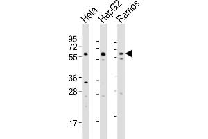 All lanes : Anti-GRK5 Antibody  at 1:2000 dilution Lane 1: Hela whole cell lysates Lane 2: HepG2 whole cell lysates Lane 3: Ramos whole cell lysates Lysates/proteins at 20 μg per lane.