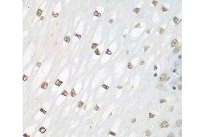 Immunohistochemistry of paraffin-embedded Human esophagus using FOSL2 Polyclonal Antibody at dilution of 1:100 (40x lens). (FOSL2 antibody)