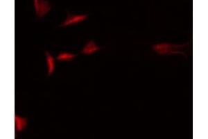 ABIN6266871 staining HepG2 by IF/ICC. (STRADA antibody  (Internal Region))