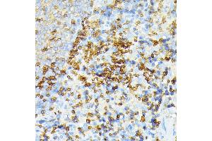 Immunohistochemistry of paraffin-embedded rat spleen using alpha 1 Spectrin antibody (ABIN6129333, ABIN6148401, ABIN6148402 and ABIN6215956) at dilution of 1:100 (40x lens). (SPTA1 antibody  (AA 940-1160))