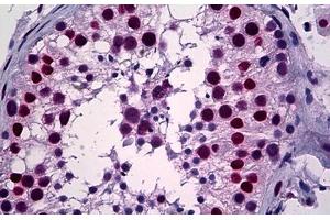 Human Testis: Formalin-Fixed, Paraffin-Embedded (FFPE) (YY1 antibody  (AA 221-321))