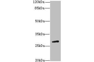 Western blot All lanes: TBC1D26 antibody at 3 μg/mL + Mouse liver tissue Secondary Goat polyclonal to rabbit IgG at 1/10000 dilution Predicted band size: 29, 25, 10 kDa Observed band size: 29 kDa (TBC1D26 antibody  (AA 1-250))