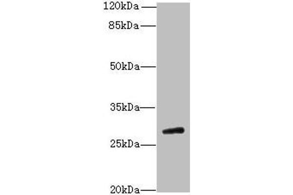 TBC1D26 Antikörper  (AA 1-250)