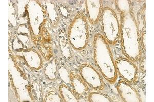 ABIN6266028 and ABIN6273347 at 1/100 staining human normal kidney tissue by IHC-P.