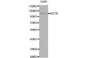 Western blot analysis of extracts of A549 cells using IGF1R antibody. (IGF1R antibody  (AA 660-760))