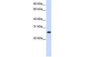 PHF19 antibody used at 0.