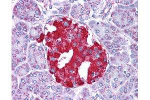 Immunohistochemistry (IHC) image for anti-Glutamate Dehydrogenase 1 (GLUD1) (N-Term) antibody (ABIN2782330)