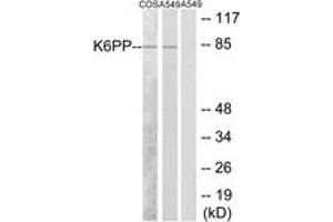 Western Blotting (WB) image for anti-phosphofructokinase, Platelet (PFKP) (AA 341-390) antibody (ABIN2889539) (PFKP antibody  (AA 341-390))