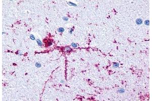 Anti-GRM8 / MGLUR8 antibody  ABIN1048945 IHC staining of human brain, neurons and glia. (GRM8 antibody  (N-Term))