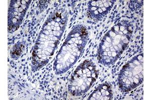 Image no. 4 for anti-Antigen Identified By Monoclonal Antibody Ki-67 (MKI67) (AA 1160-1493) antibody (ABIN1490857) (Ki-67 antibody  (AA 1160-1493))