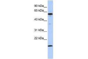 Human Jurkat; WB Suggested Anti-TRIP10 Antibody Titration: 0. (TRIP10 antibody  (Middle Region))