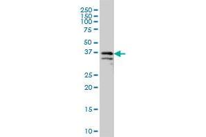 ARMCX3 monoclonal antibody (M01), clone 2G3 Western Blot analysis of ARMCX3 expression in COLO 320 HSR