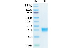 Biotinylated Human IL-17F on Tris-Bis PAGE under reduced condition. (IL17F Protein (His-Avi Tag,Biotin))