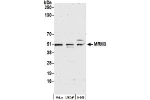 anti-RNA Methyltransferase Like 1 (RNMTL1) (AA 325-375) antibody