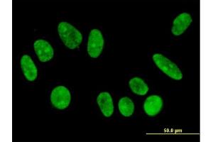 Immunofluorescence of monoclonal antibody to FBXO11 on HeLa cell. (FBXO11 antibody  (AA 744-843))