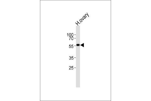 MPP7 Antikörper  (N-Term)