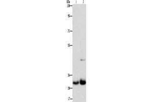 Gel: 8 % SDS-PAGE, Lysate: 40 μg, Lane 1-2: Lovo cells, PC3 cells, Primary antibody: ABIN7130253(MPG Antibody) at dilution 1/950, Secondary antibody: Goat anti rabbit IgG at 1/8000 dilution, Exposure time: 1 minute