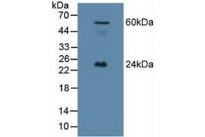 Detection of EFNA1 in Mouse Testis Tissue using Polyclonal Antibody to Ephrin A1 (EFNA1) (Ephrin A1 antibody  (AA 19-182))