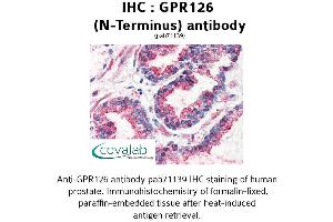 Image no. 2 for anti-G Protein-Coupled Receptor 126 (GPR126) (N-Term) antibody (ABIN1734925) (G Protein-Coupled Receptor 126 antibody  (N-Term))