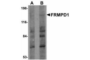 Image no. 1 for anti-FERM and PDZ Domain Containing 1 (FRMPD1) (C-Term) antibody (ABIN478185)
